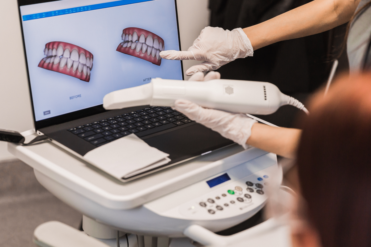 empreinte numerique dentaire empreinte numerique dentaire Nos technologies Dr Johan Cinçon - Chirurgien-dentiste à La Teste-de-Buch